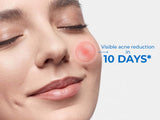 D'Acne Foaming Face Wash